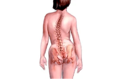 Gründe für die Entwicklung einer zervikalen Osteochondrose