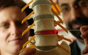 Symptome und Behandlung der Osteochondose der Brustwirbelsäule