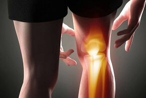 Zerstörung des Kniegelenks durch Arthrose