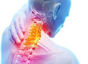 Schmerzen und Stechen im Halsbereich bei Osteochondrose dritten Grades
