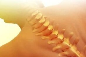 Osteochondrose, wie man behandelt