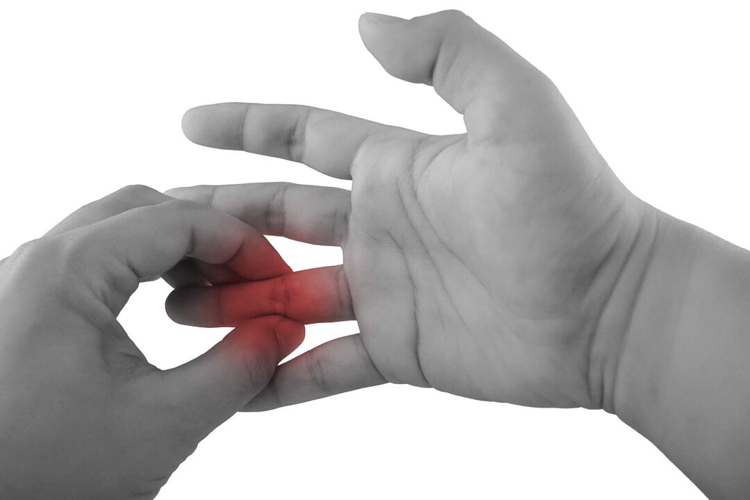 Entzündungen der Fingergelenke als Schmerzursache